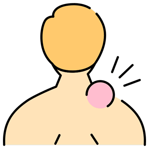 Hepatocellular Carcinoma