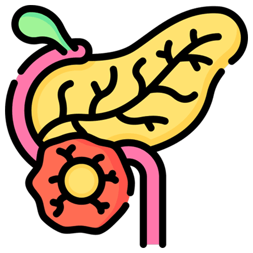 Pancreatic cancer